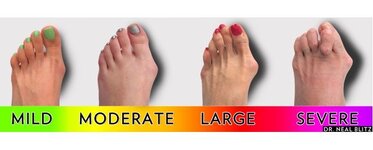 ugly.feet.jpg ugly.feet.jpg
