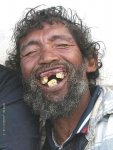 Ugly-smile.jpg